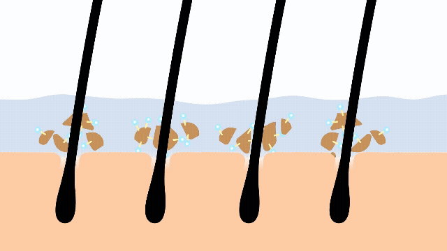 皮脂を浮かび上がらせるイメージ